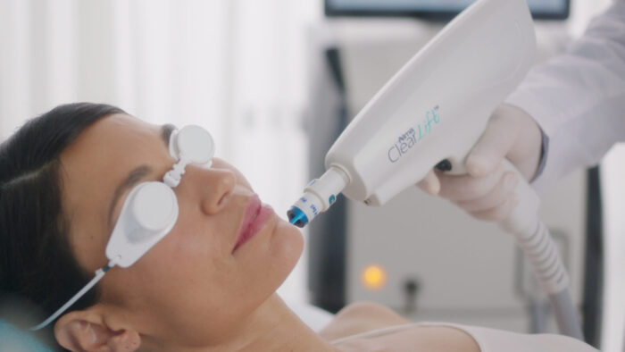 ClearLift Laser – Gentle Rejuvenation