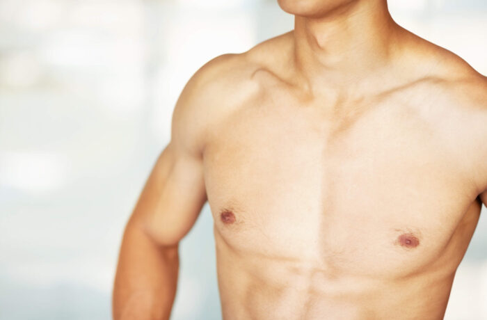 Gynecomastia Surgery