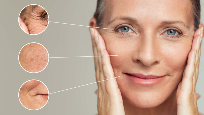 iPixel Laser – Fractional Resurfacing